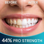 Close-up before-and-after comparison of a person's smile, showing yellowed teeth on the left and brighter white teeth on the right, with text reading BEFORE, AFTER, and 44% PRO STRENGTH.