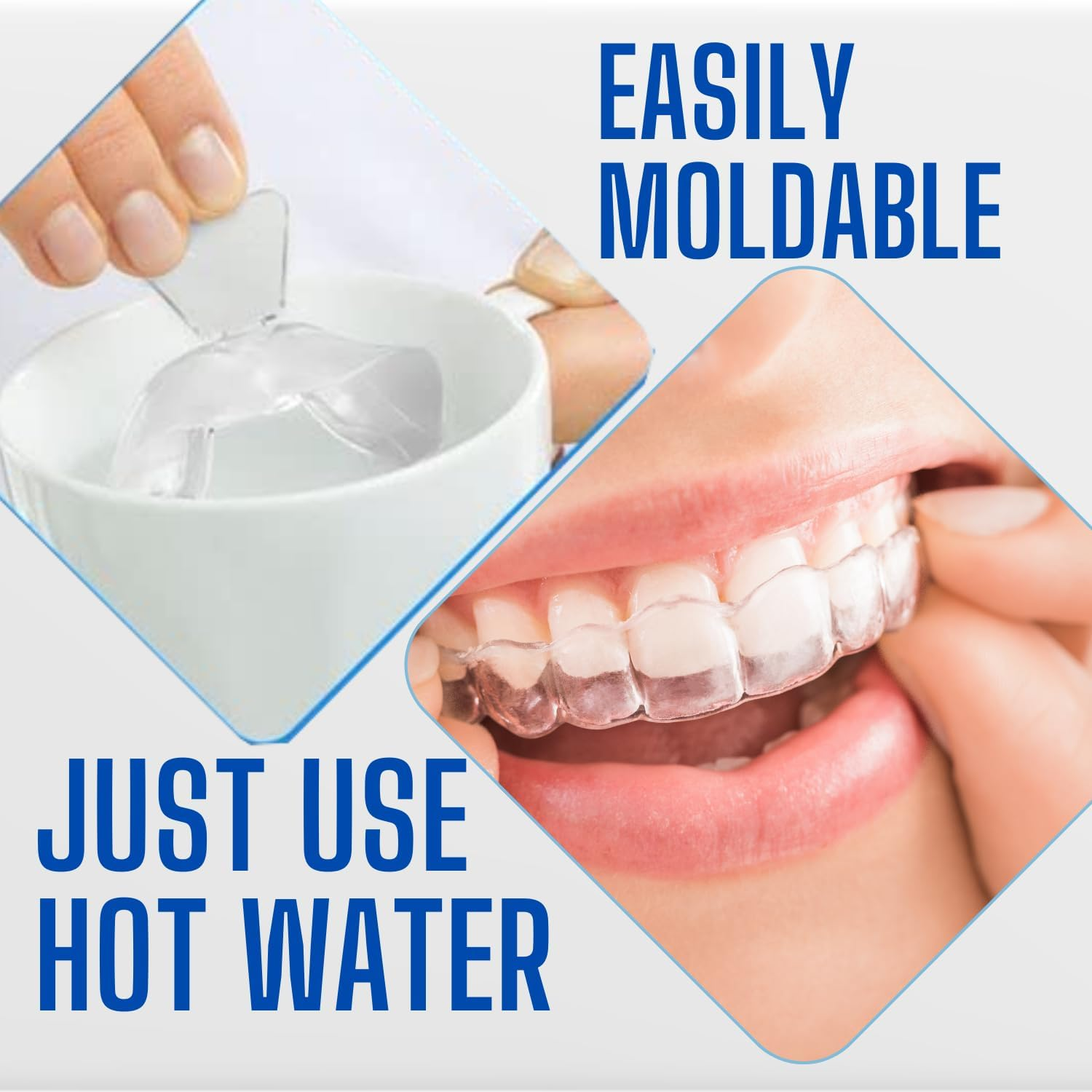 Moldable Teeth Whitening Trays + LED Light